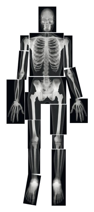 Röntgenbilder människoskelett