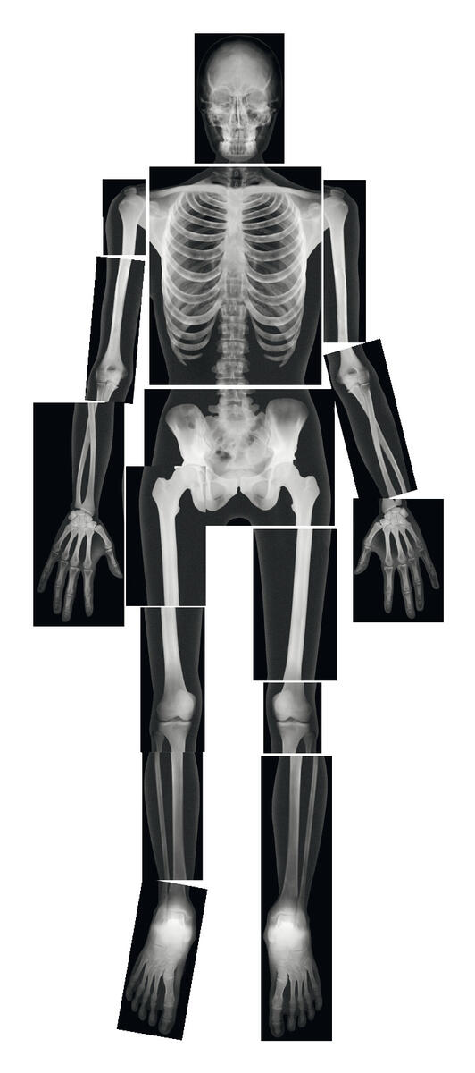 Röntgenbilder människoskelett